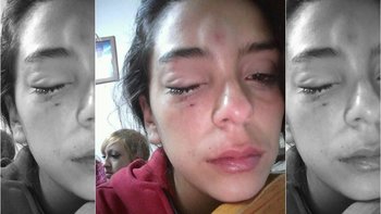 Denuncio Que Su Ex Novio La Golpeo Hasta Dejarla Inconsciente